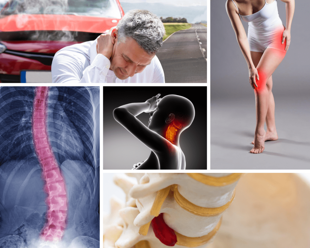 conditions chiropractic can treat photo